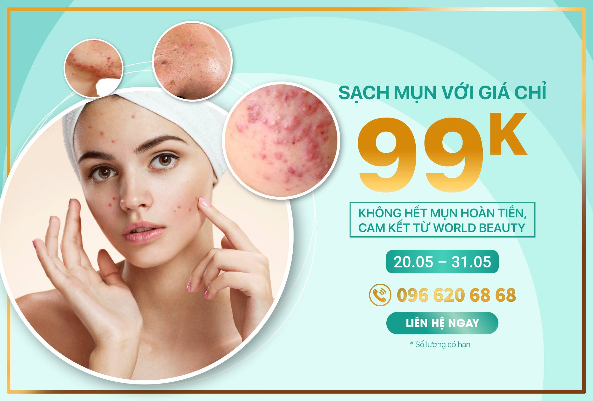 ĐIỀU TRỊ MỤN CHỈ VỚI GIÁ 99k