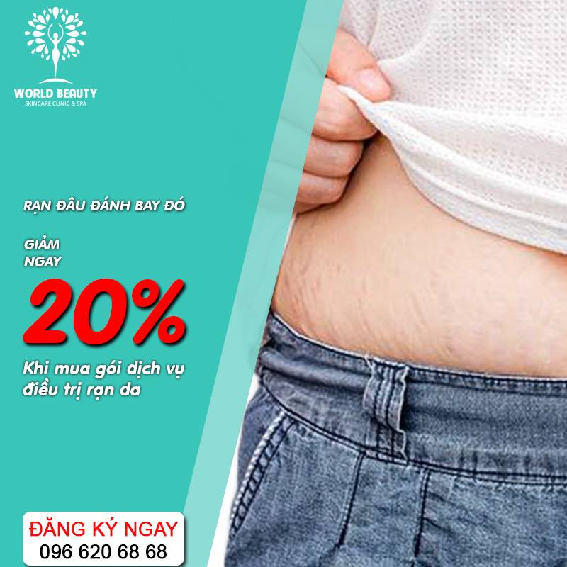 Giảm giá điều trị rạn da