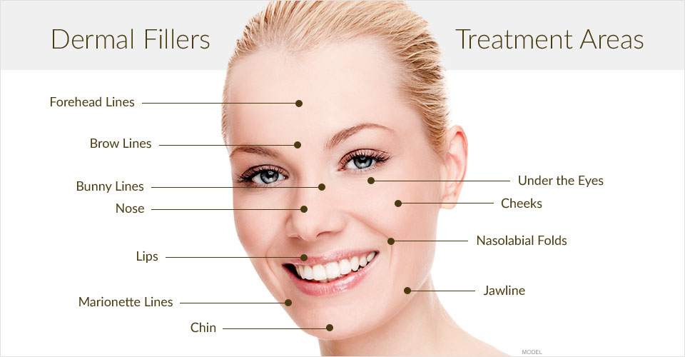 DERMAL FILLERS – GIẢI PHÁP CHỐNG NHĂN DA