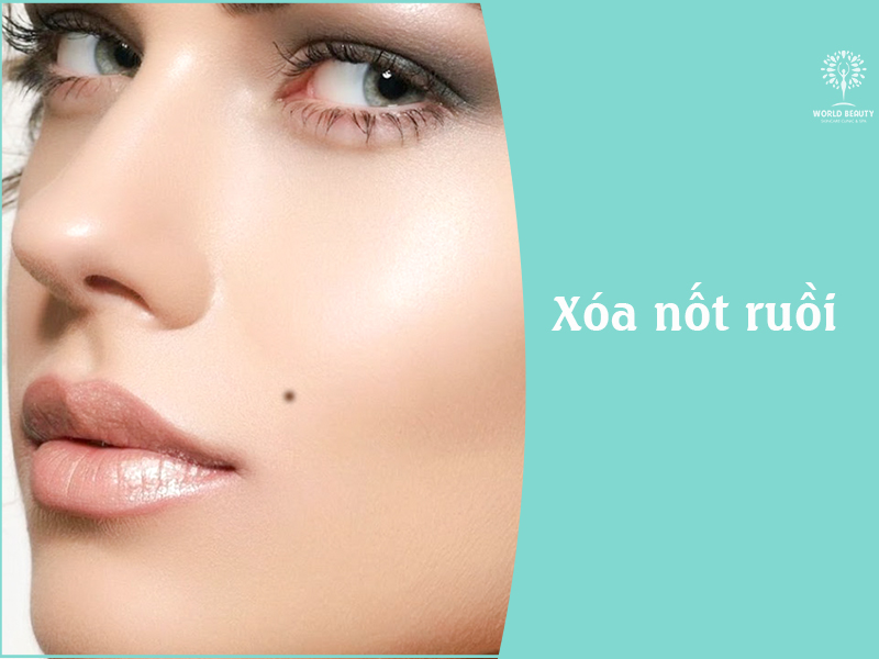 Xoá nốt ruồi