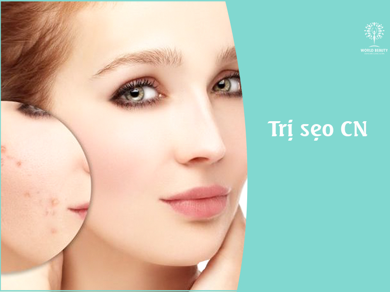 Điều trị sẹo công nghệ 2in1