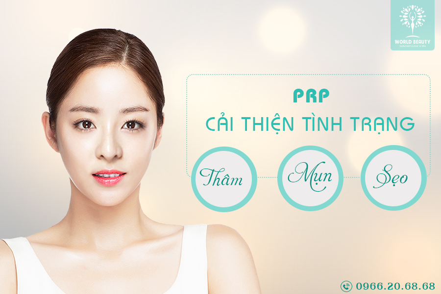 PRP – CẢI THIỆN TRIỆT ĐỂ TÌNH TRẠNG THÂM – MỤN – SẸO