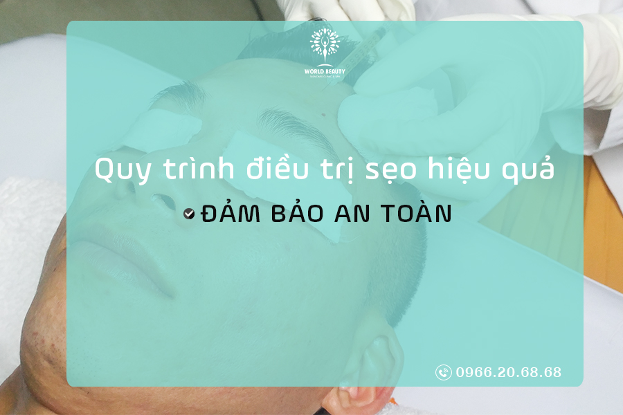 QUY TRÌNH ĐIỀU TRỊ SẸO HIỆU QUẢ BẰNG LASER CO2 FRACTIONAL