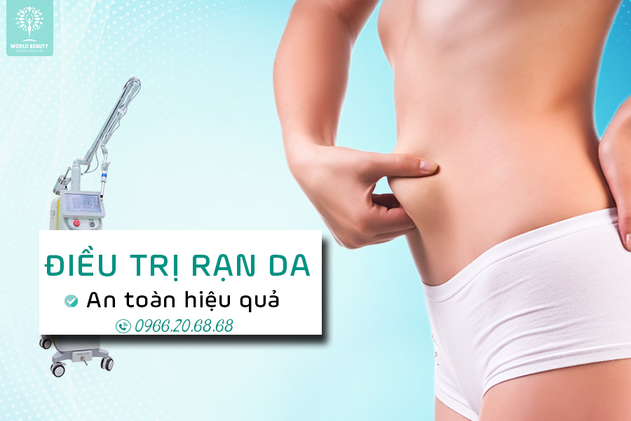 HIỆU QUẢ CỦA VIỆC ĐIỀU TRỊ RẠN DA BẰNG LASER