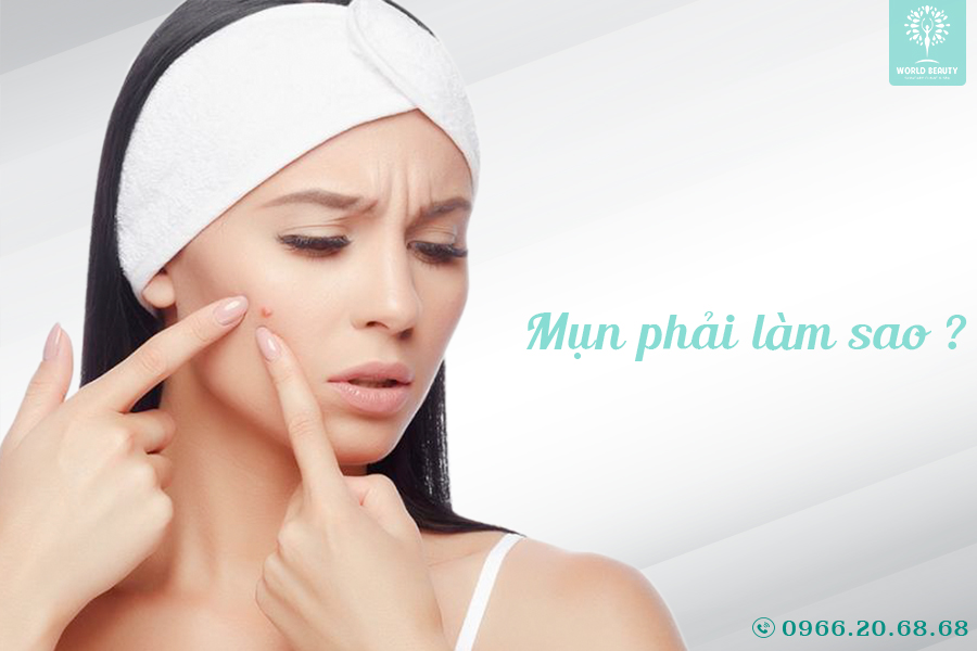 MỤN PHẢI LÀM SAO?