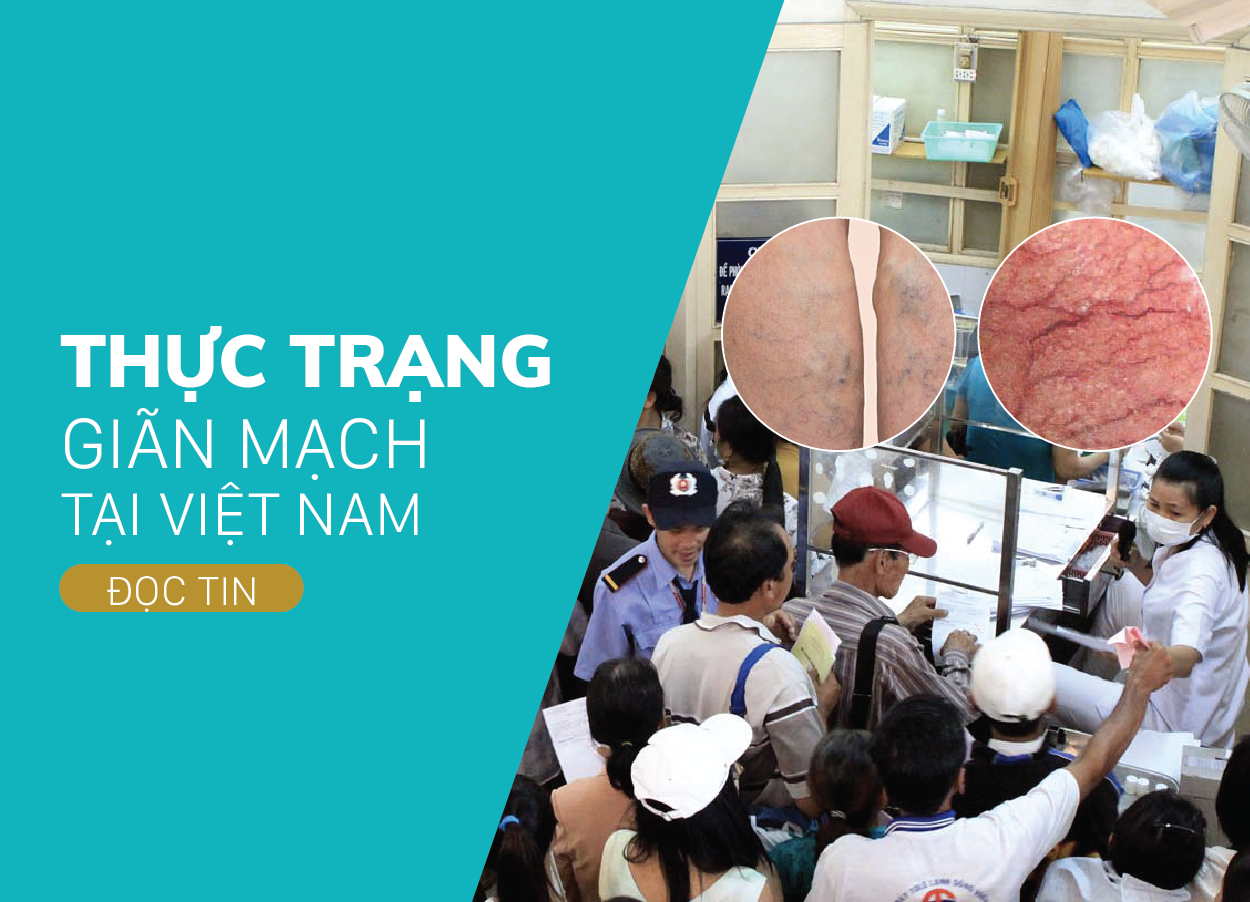 Giãn Mao Mạch là gì? Thực Trạng Giãn Mao Mạch Tại Việt Nam.